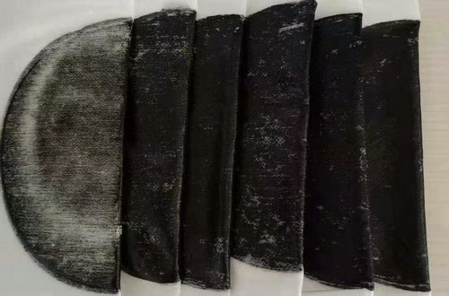 中醫在治療復雜病癥方面有哪些優勢